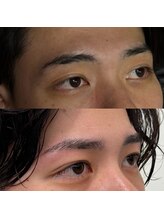 ブリス 姫路(Bliss)/お客様Before/After