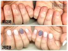 モアナ 池袋(MOANA)/人工爪深爪
