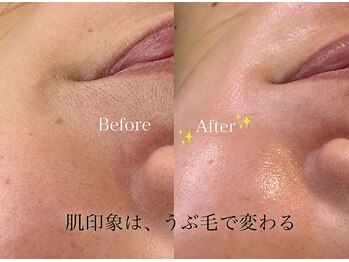 ルシーア アコ(Lucia Aco)の写真/フェイスワックスで産毛や古い角質をオフし、素肌美人に