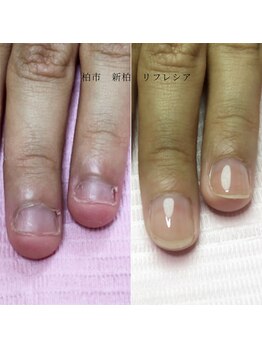 リフレシア(Rifrecia)/指先に自信がつく