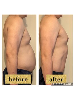 マンダ 田町(Manda)/食事制限が苦手な方にもおすすめ