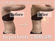 エステサロン ヴリエ 立川店の雰囲気（気になっていたお腹脂肪は脂肪ではなく姿勢が原因かも★）