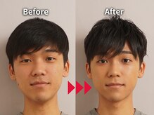メンズメイク コレクション 名古屋店/Before After