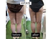 リメイクボディ センダイ(Re.Make Body SENDAI)/高校生・大学生も多数来院♪