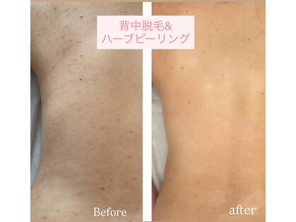 テンピスモ(tempismo)の写真