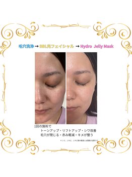 リゾートサロンドマーレ(Resort Salon de MARE)/MARE ALL FACIAL