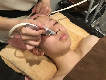 ヴィヴィアナ(VIVIANA)の写真/美肌とツルスベ肌が同時に手に入るお顔脱毛は当店にお任せください♪化粧乗りUPで毎朝の時短に☆