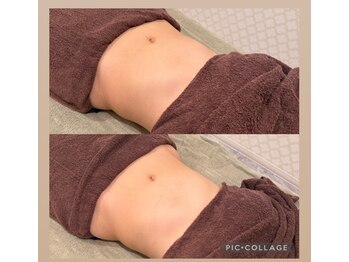 シャルム(CHARME)/腸けずり