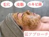 【毛穴・頑固なニキビに】肌質改善ハーブピーリング