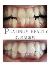 プラチナムビューティー 名古屋栄本店(PLATINUM BEAUTY)/お客様Before After