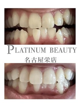 プラチナムビューティー 名古屋栄本店(PLATINUM BEAUTY)/お客様Before After