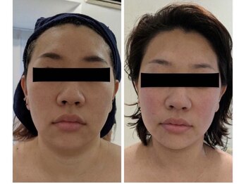 エムプリュ 心斎橋店(M.plus)/フェイシャル★★★