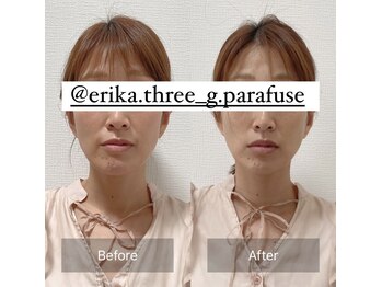 スリージー/before/after