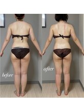 エヌボーテ(N. beaute)/全身痩身4回目コース