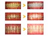 【当日予約限定!8分×2回】まずは手軽にホワイトニング体験¥4980→¥1100