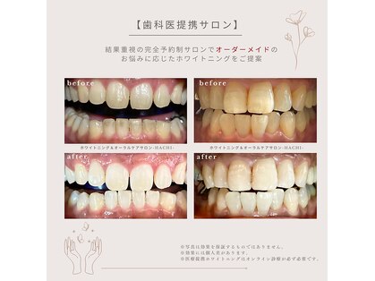 ハチ(HACHI)の写真