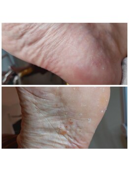 爪切り屋 足楽/