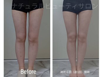 ナチュラルビューティサロン/継続的なケアが結果を定着♪