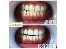 ルブラン 奈良店(Le Blanc)/笑顔に自信！