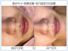 フェアリー(fairy)/