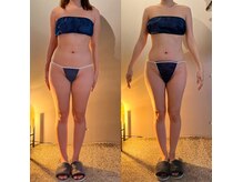 ヴェレン(Wellen)/ビフォーアフター