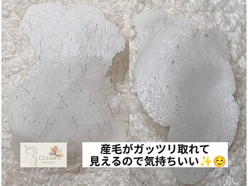 クリアホワイト(Clear White)/こんなとこに産毛があったの？汗