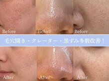 毛穴&シミ専門店メディカルサロン CLARIS大宮店【クラリス】の雰囲気(【毛穴・シミ・ニキビ・肌荒れ】などあらゆるお悩みに/大宮)