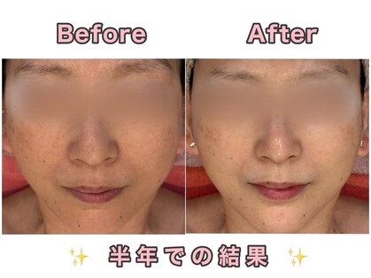メディカルエステサロン ローズ 福井高柳店(ROSE)の写真
