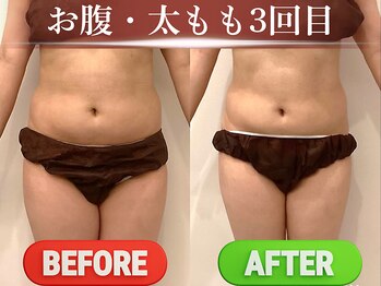 ロージュ 岐阜茜部サロン(Loge)の写真/「エステサロンは敷居が高い」「ジムのマシンでは物足りない」本格マシンを扱うセルフエステ"専門店"です♪