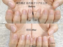 ヴェルニ(VERNI)の雰囲気（バレない自爪風ネイルで深爪を緩和！足の深爪ネイルも同時施術◎）