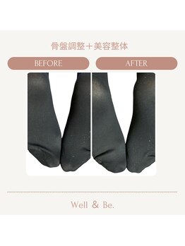 ウェルビー(Well & Be.)/【骨盤矯正+美容整体】