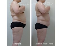 ナチュラルビューティサロン/受けるだけ！有酸素運動と同等★