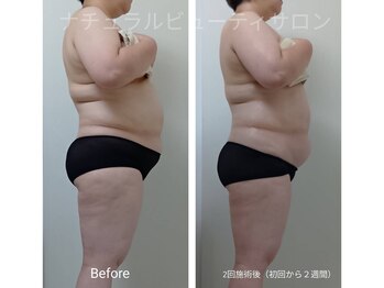 ナチュラルビューティサロン/受けるだけ！有酸素運動と同等★