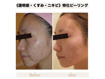 カナウ produced by きょうわ整体院(Kanau.)の写真