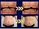 整体ルーム な～るの写真/40代50代の大人女性の悩みに◎だるだるハミ肉だけじゃない、岩盤のようなコリも微弱電流の深層刺激で解消！