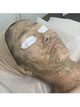 エソール(essor)/ハーブピーリング