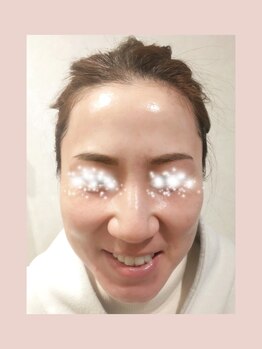 エタニティ 西宮店(Eternity)/艶肌フェイシャルハンドエステ