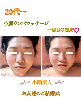 萬裡(マリン)/オールハンド小顔になりたい方へ