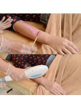 グルーミー(gloomy)/効果抜群◎人気のMIX脱毛♪