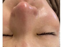 アンドモア 目黒(&more)の雰囲気（1回でつるつる美肌に！）