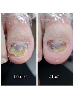 爪切り屋 足楽/