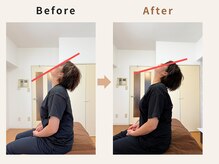 ハリデイズ/40代-肩首こり、頭痛、腰痛