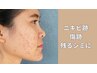 ニキビ・傷跡から居座る茶色いシミに【ハーブピーリング×集中シミケア】
