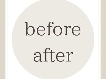 ヒナノ 矢場町店(HINANO)/ビフォーアフター