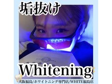 ホワイトニングサロン ホワイト(WHITE)/セルフホワイトニング/大阪/福島