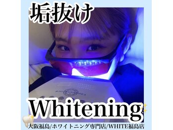 ホワイトニングサロン ホワイト(WHITE)/セルフホワイトニング/大阪/福島