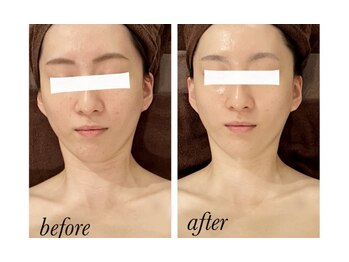 ナチュラルビューティサロン/小顔実感☆1回でも効果実感！？