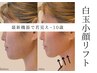 【糸リフト級UP】脂肪・たるみケアができる!小顔造顔-白玉小顔リフトコース