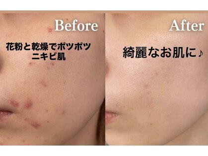 イリゼ(IRISE)の写真