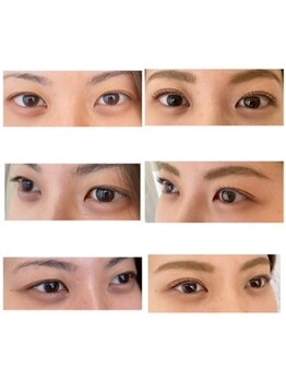 アール(R)/まつ毛カールビフォーアフター